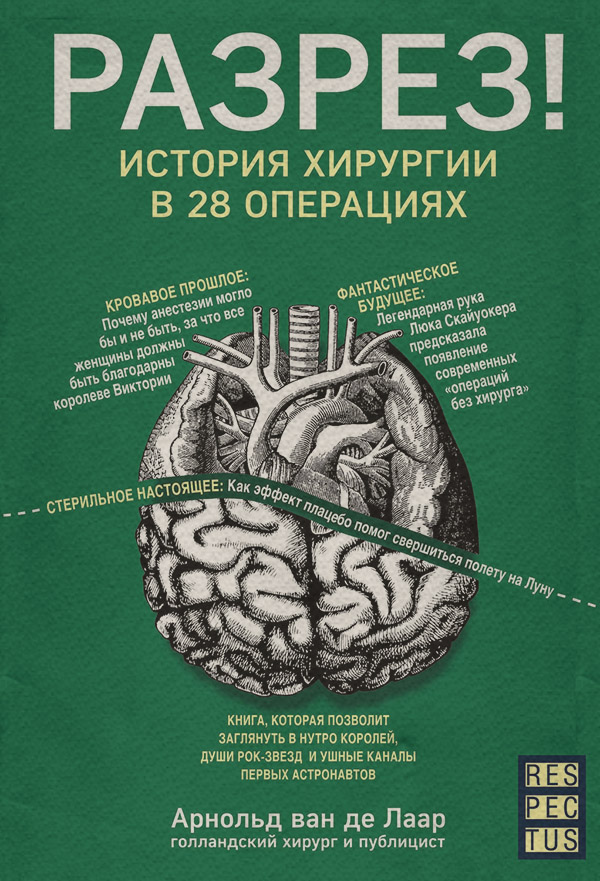  Разрез! История хирургии в 28 операциях(Арнольд Лаар) 